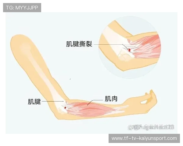 足坛伤病季：关节与肌腱高发部位统计，肌腱是关节囊吗
